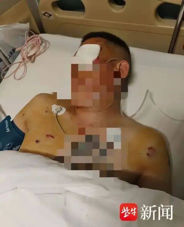 丹佛掘金 vs 达拉斯独行侠
_男子取170万元现金银行门口遭抢丹佛掘金 vs 达拉斯独行侠
，工作人员无动于衷